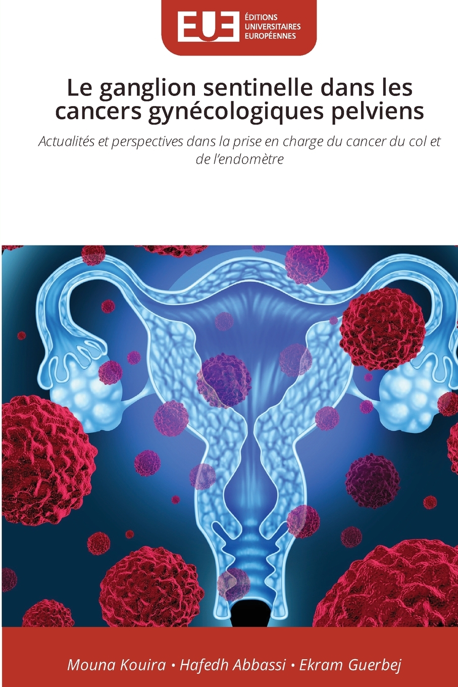 Senticol Buy Le ganglion sentinelle dans les cancers gynécologiques pelviens ...